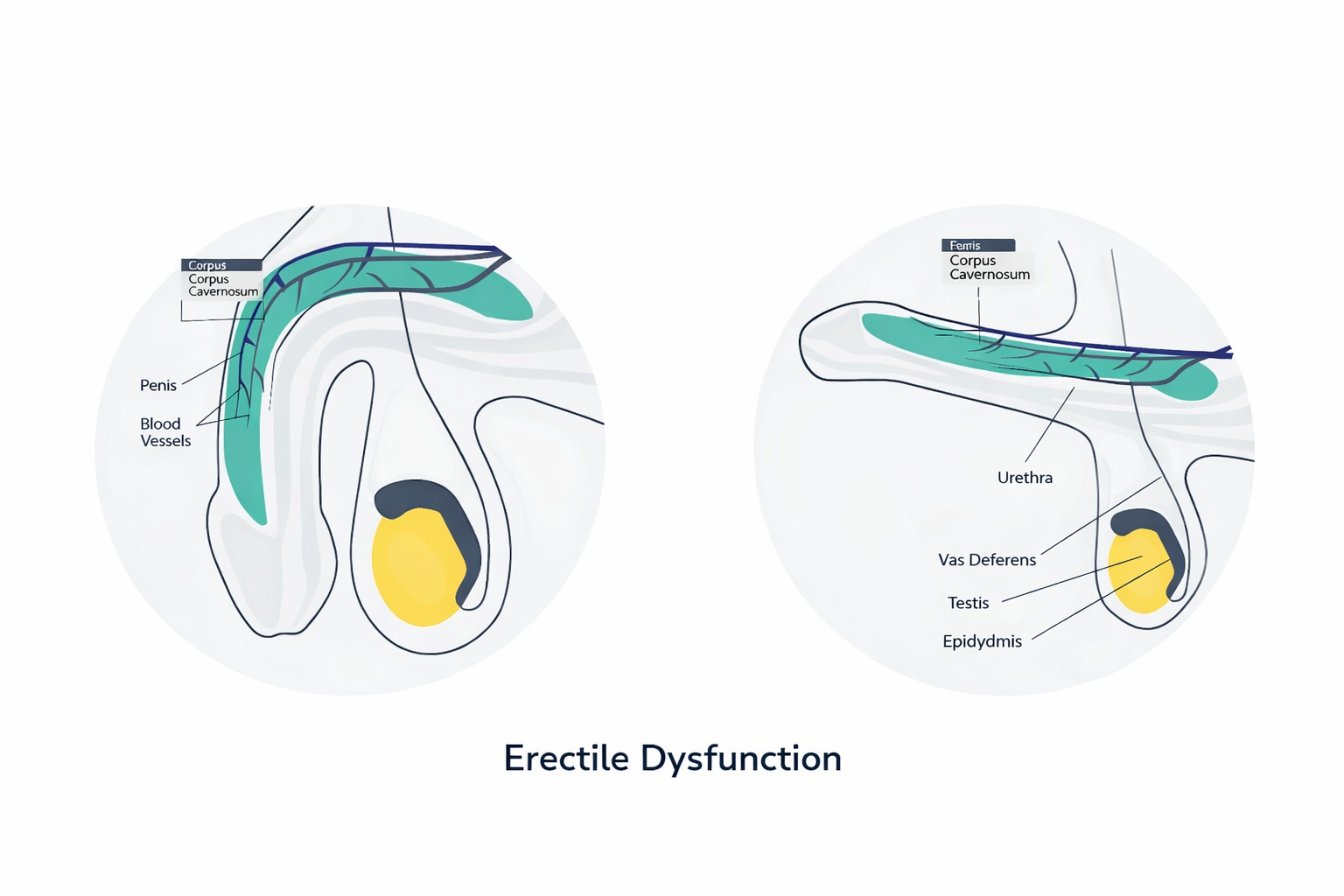 erectile dysfunction treatment in turley erectile dysfunction treatment in turley