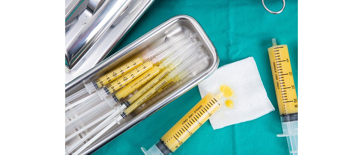 lipofilling