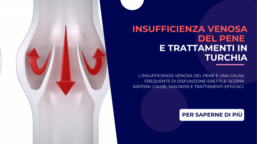 Insufficienza venosa del pene