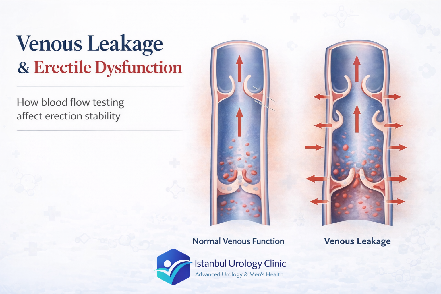 Venous Leakage Treatment: Why Pills Fail & What Actually Works
