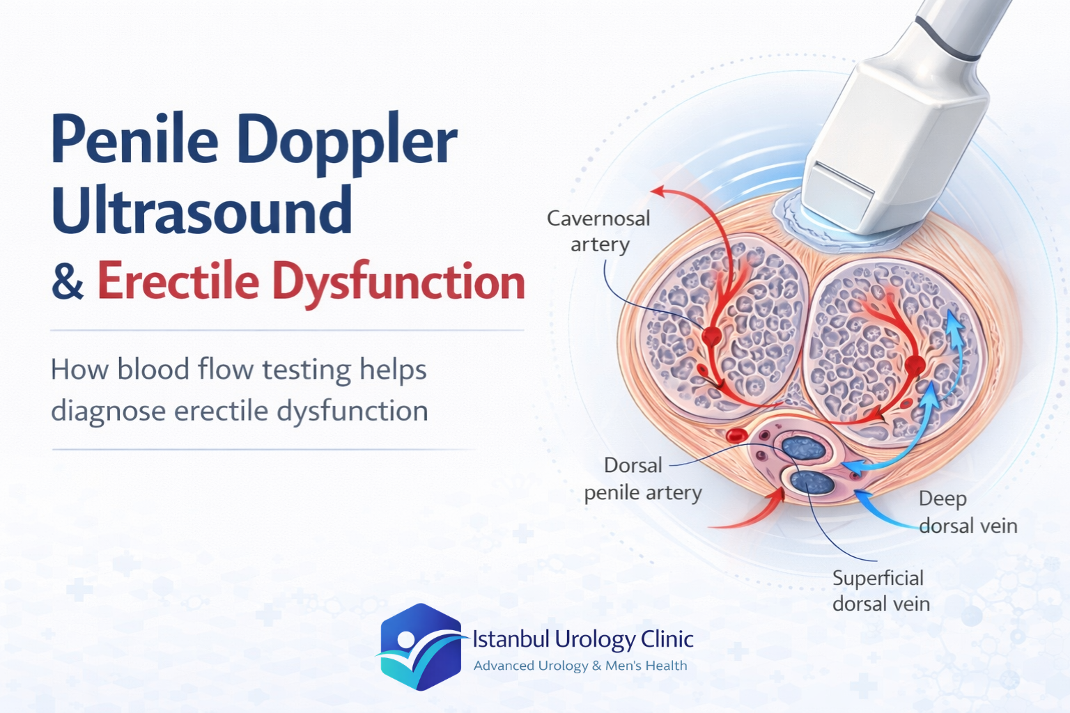 Penile doppler ultrasound